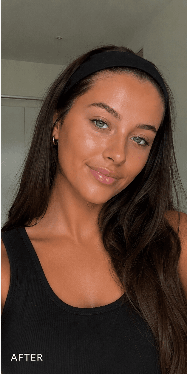 Mila — after drops