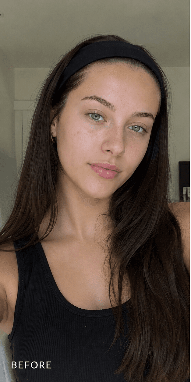 Mila — before